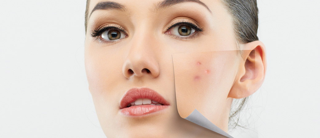 Pimple Treatment Clinic