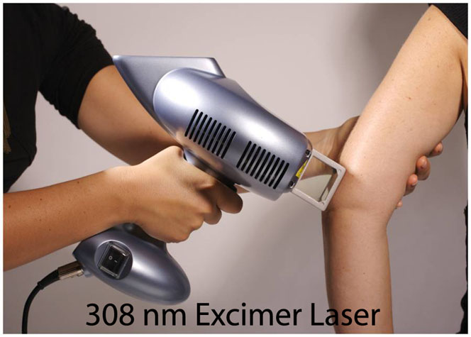 Excimer Laser Procedure